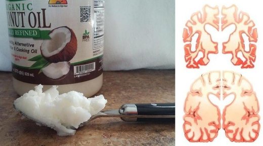 Coconut oil and the brain