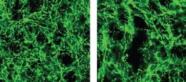 dopamine neurons