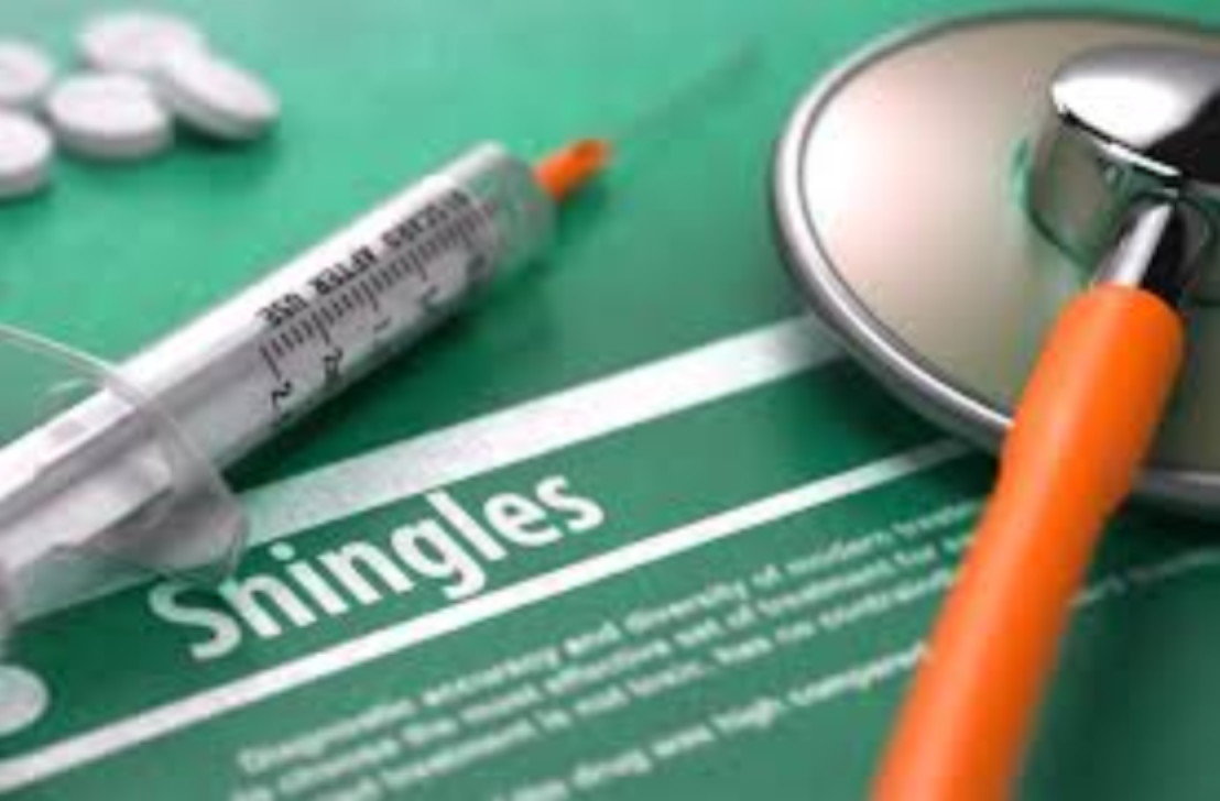 shingles