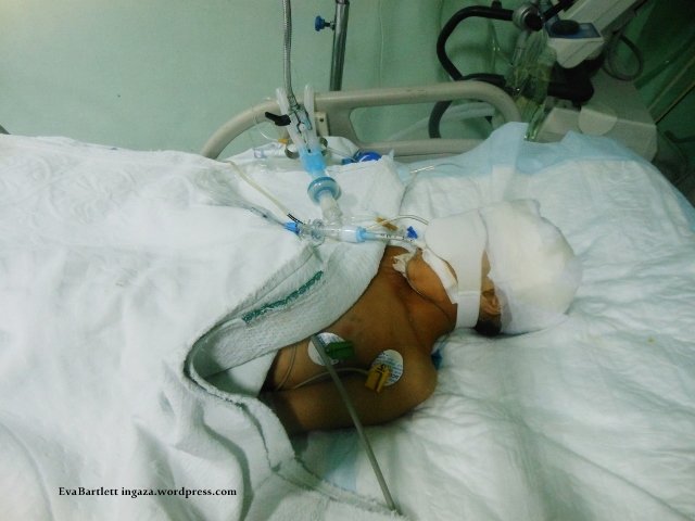 syrian child hospital