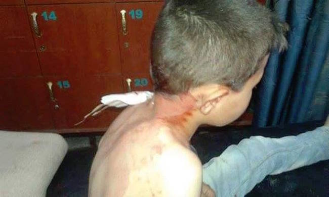Click to enlarge syrian child hurt