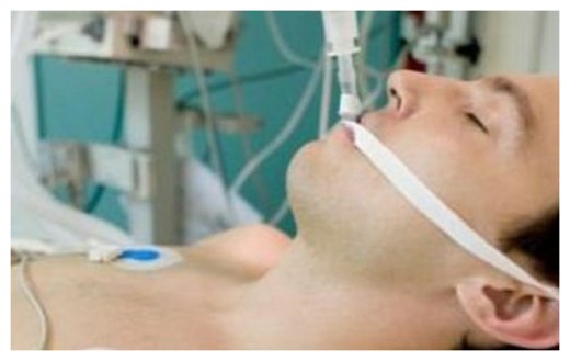 Coma Patient