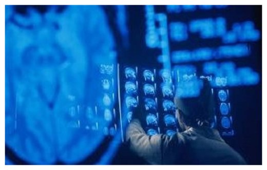 MRI Scan