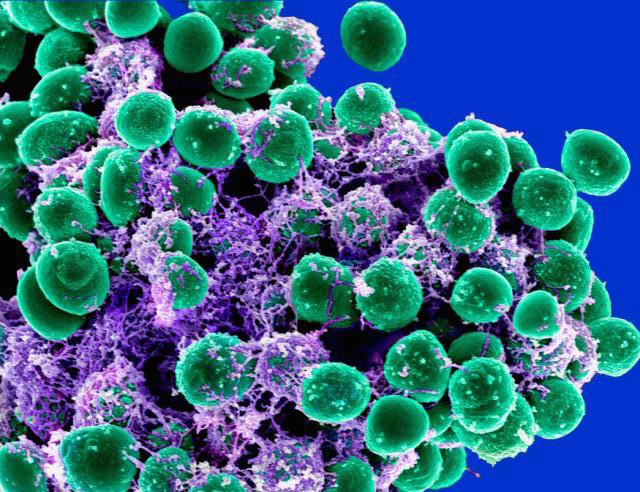 Click to enlarge microbes