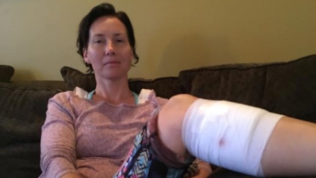 Raschel Zeschuk, 40, got six stitches and a series of rabies shots but feels very lucky.  