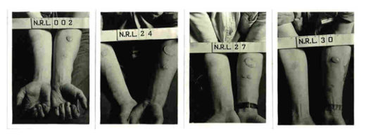 Click to enlarge Forearms of human test subjects