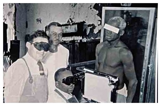 Click to enlarge The Tuskegee Syphilis Study