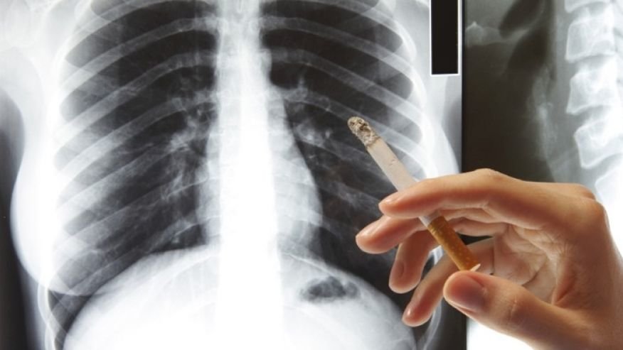 smokers lungs