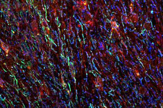 Click to enlarge gut-brain