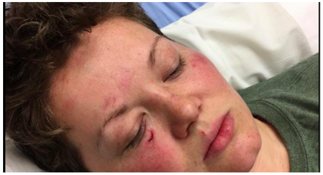 battered ky woman