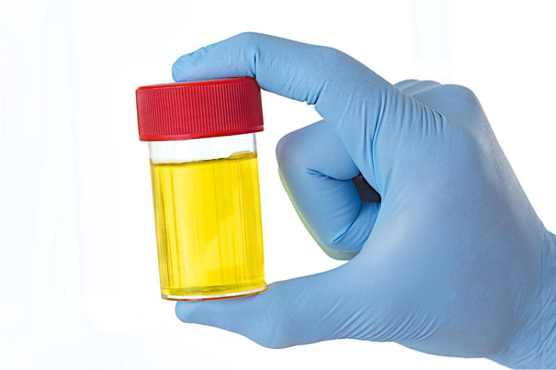 urine