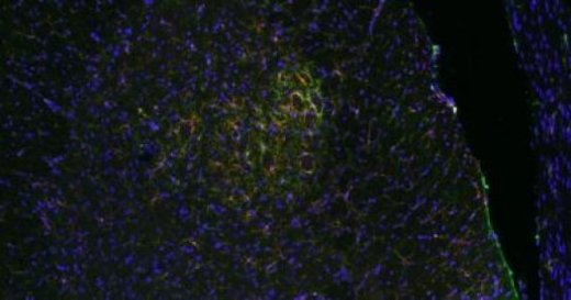 Click to enlarge microglial cells