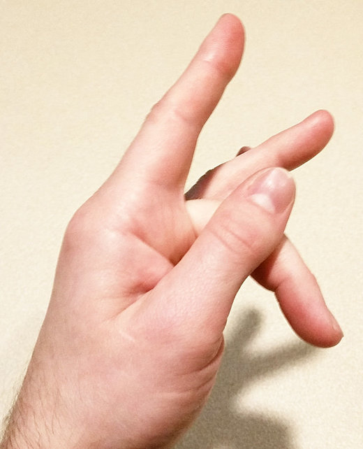 Click to enlarge virus hand mode applied kinesiology foxx