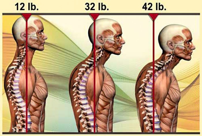 Spine
