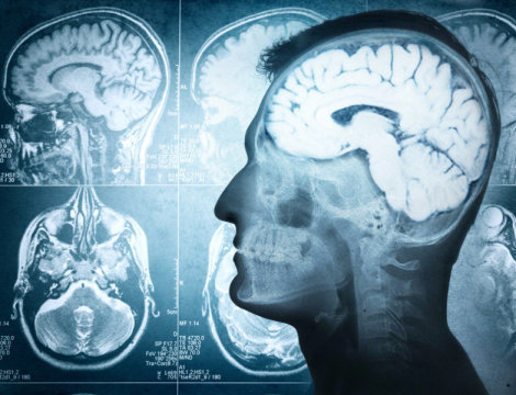 Click to enlarge brain imaging
