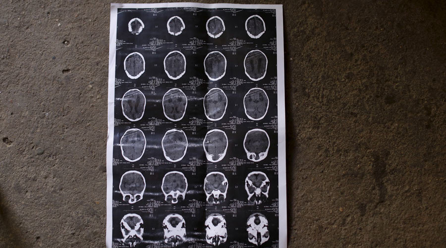 Click to enlarge MRI images
