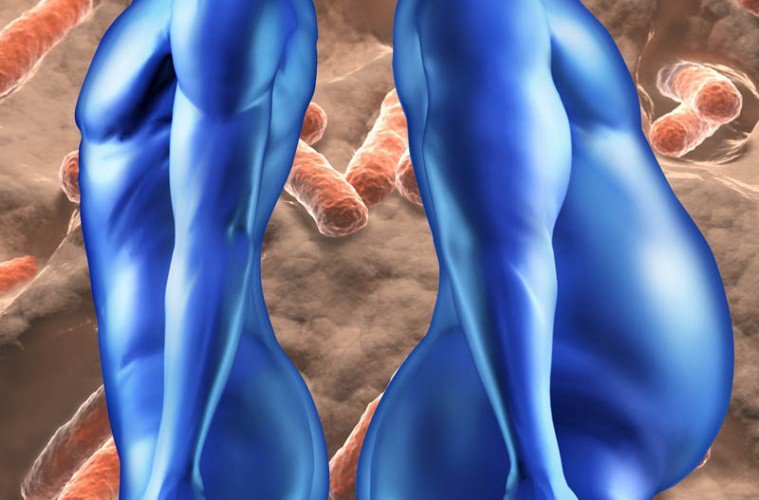 gut bacteria