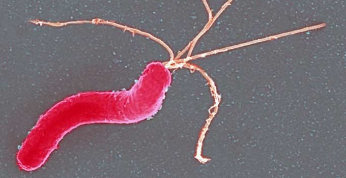 Click to enlarge h pylori, helicobater pylori