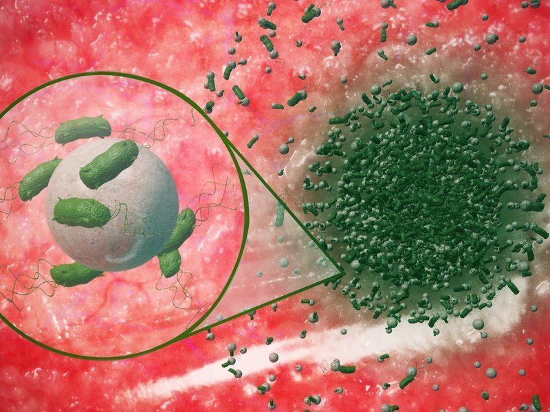microparticles