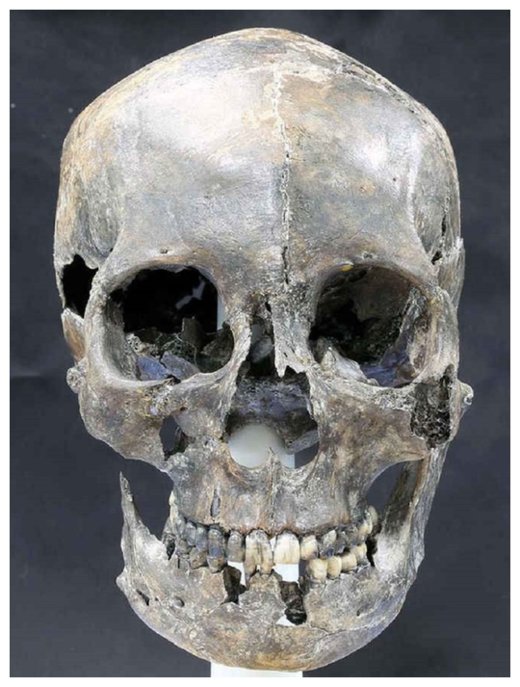 Click to enlarge Long Headed Skull