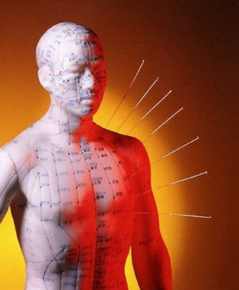 Click to enlarge acupuncture