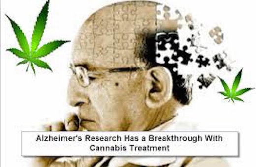 Click to enlarge Alzheimers Research