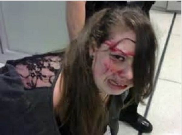 teen beaten by cops