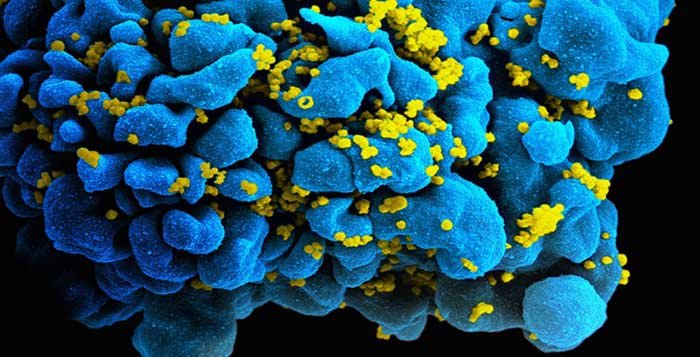 gene editing