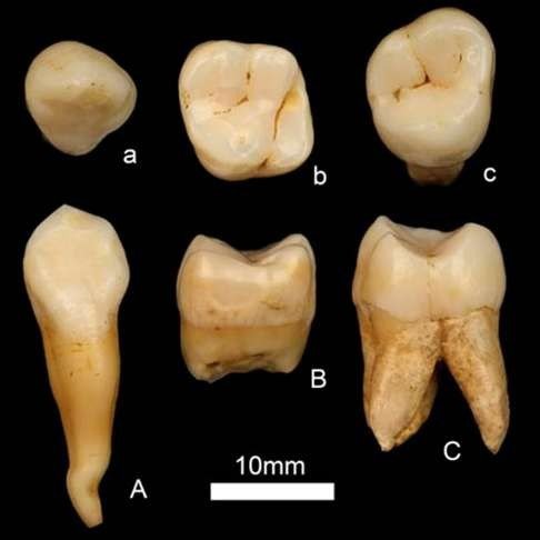 Teeth