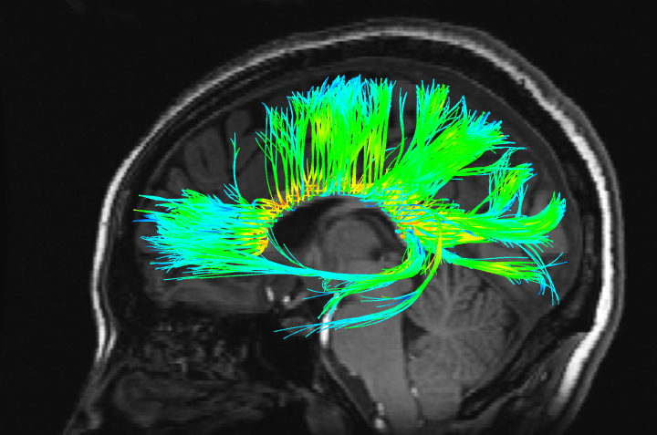 fmri