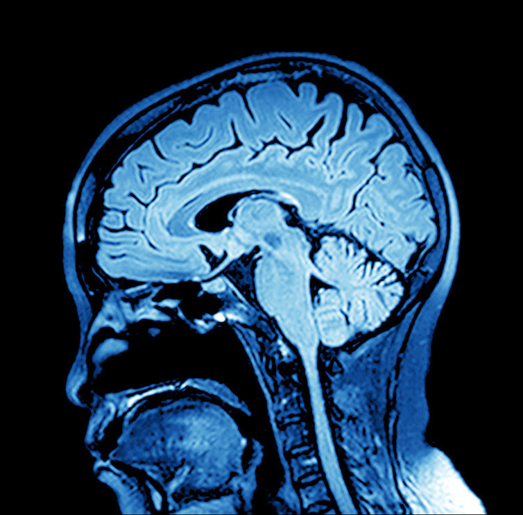 Click to enlarge brain image