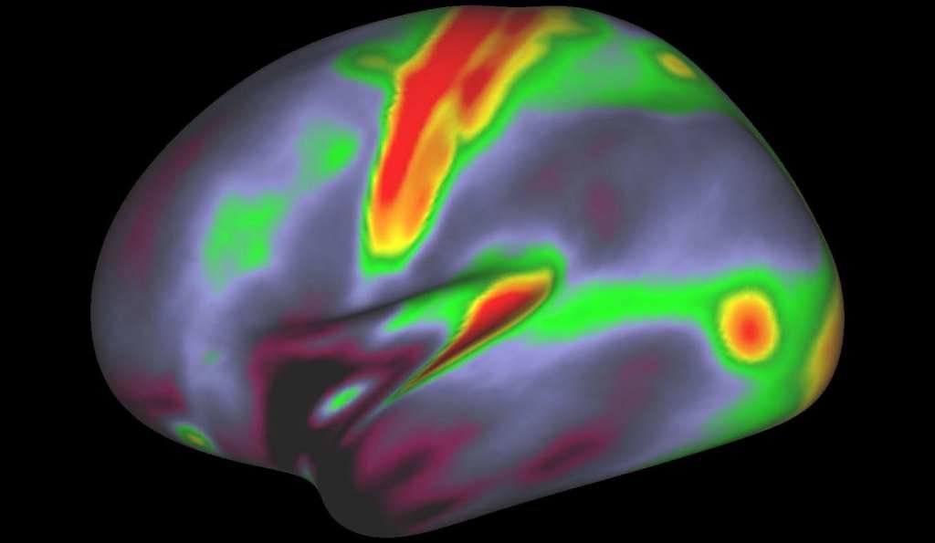 left hemisphere