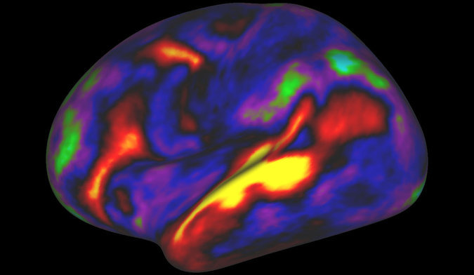 brain activation