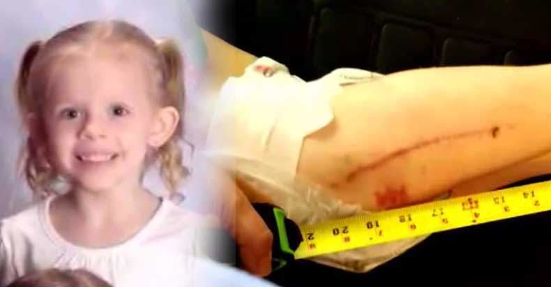 police shoot girl