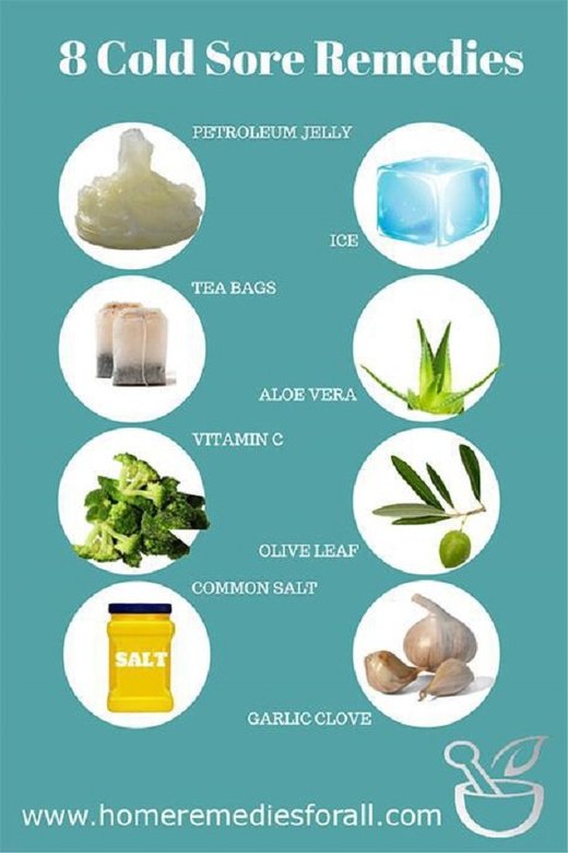 natural cold sore remedies
