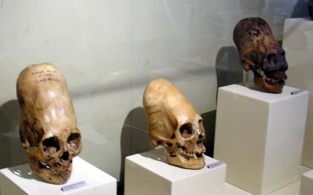 elongated skulls