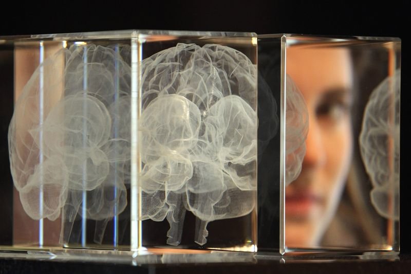 Click to enlarge brain