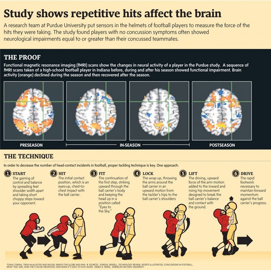 head injury science