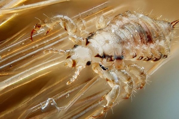 male head lice
