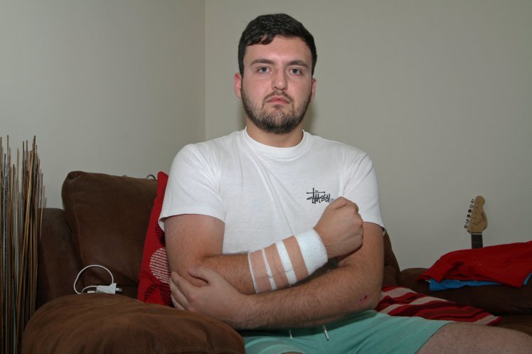 Darren Scott, 24, was attacked by a cat in Invergowrie 