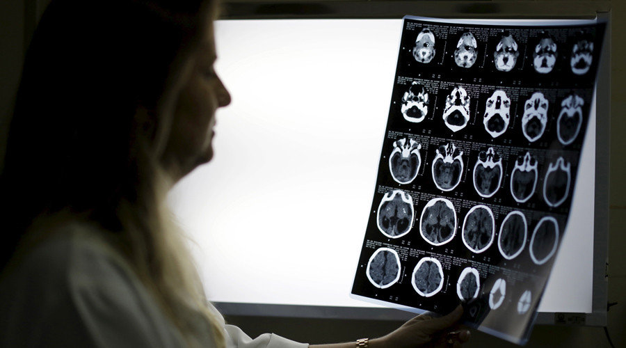Click to enlarge brain MRI scans