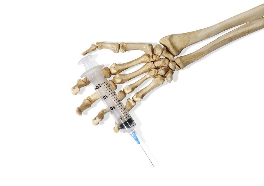 Click to enlarge skeleton needle