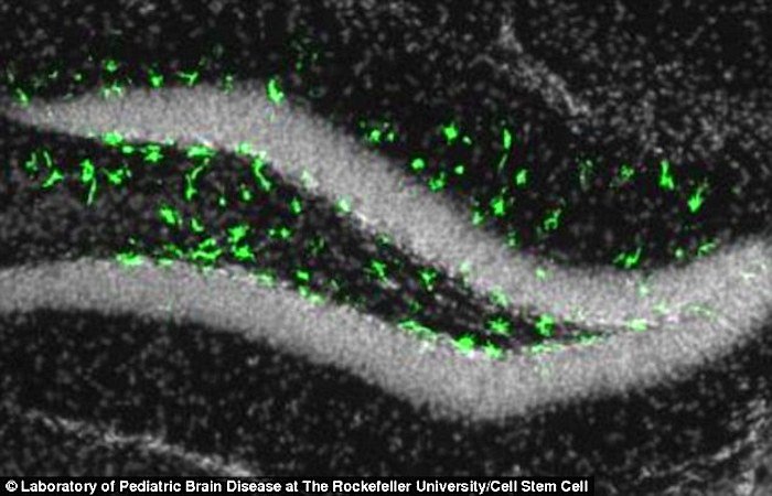Click to enlarge mouse brain green specs