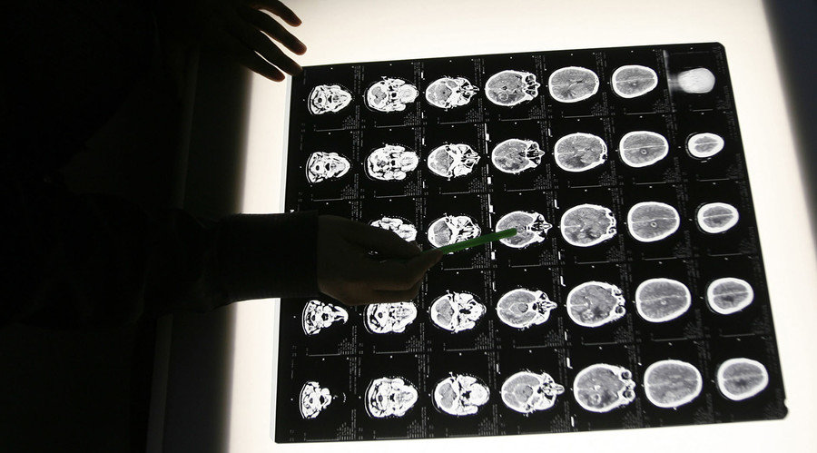 childhood head injuries mental health