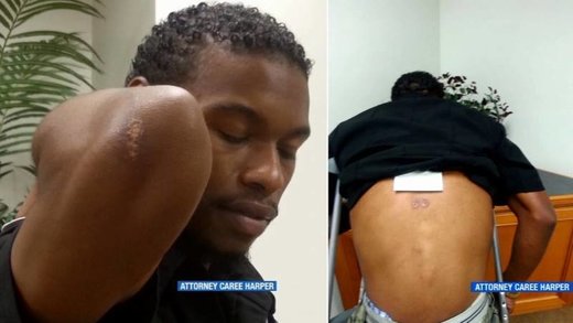 Click to enlarge clifton alton cop assault