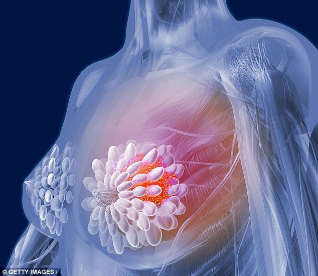 breast