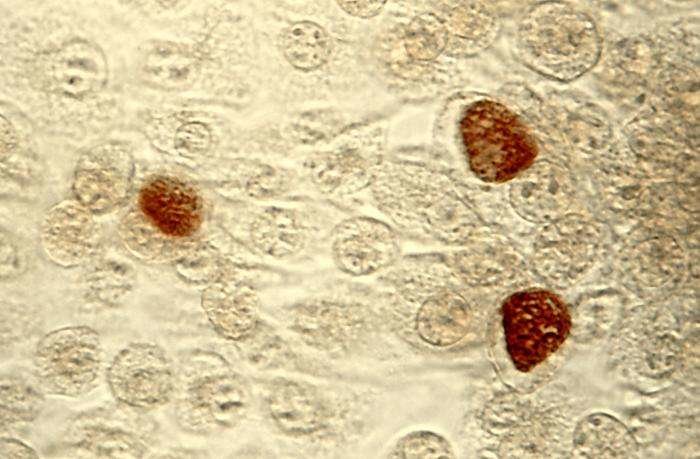 Click to enlarge chlamydia cell culture