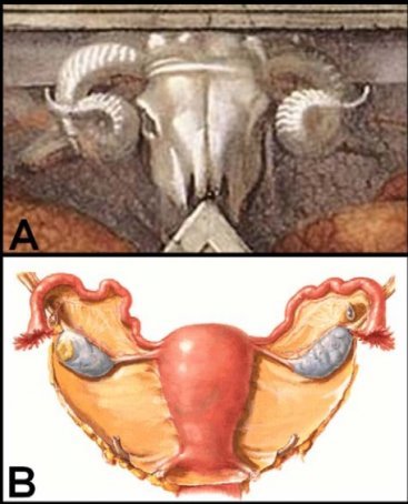 Click to enlarge Ram Skull Sistine Chapel