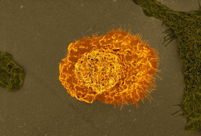 Macrophage