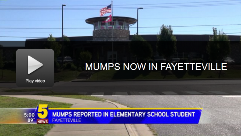mumps